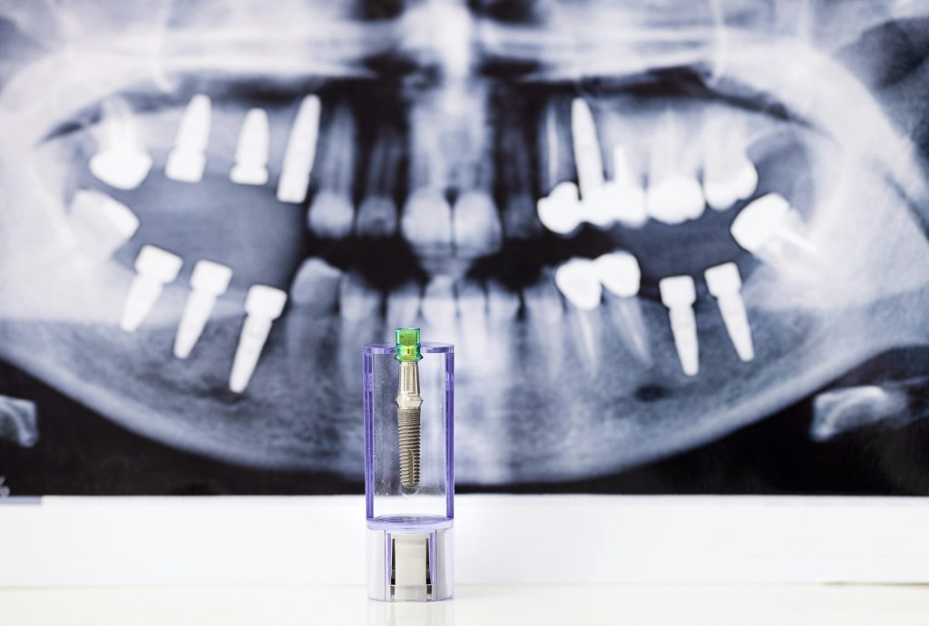 Dental Implant and x-ray picture as background