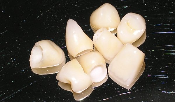 corona_porcelana corona_porcelana